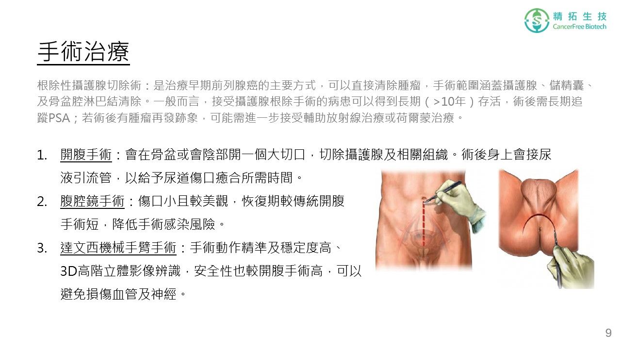 攝護腺癌 治療簡介 投影片 第 9 頁